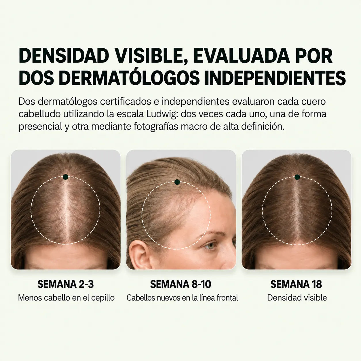Nutrafol Women — Fórmula de crecimiento Capilar