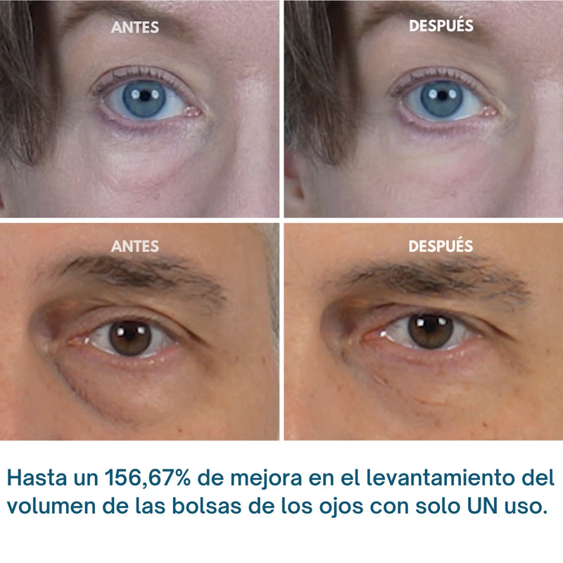 Tratamiento  para Ojeras y Bolsas Paga 1 LLeva 2